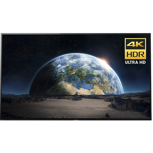Sony XBR77A1E 77-Inch 4K Ultra HD Smart BRAVIA OLED TV (2017 Model)